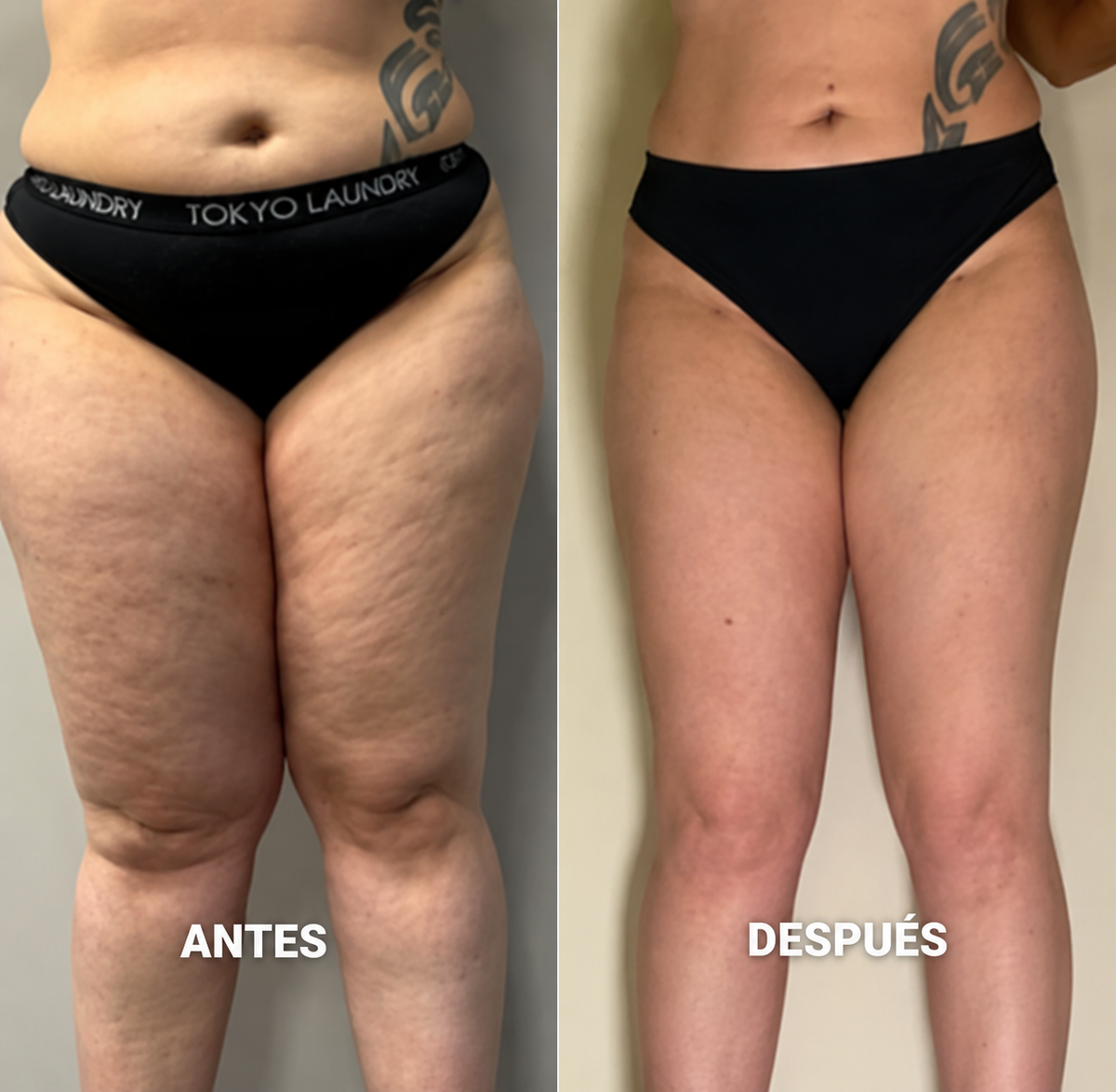 Lymphatic Drainage: Drena lo que tu cuerpo ya no necesita