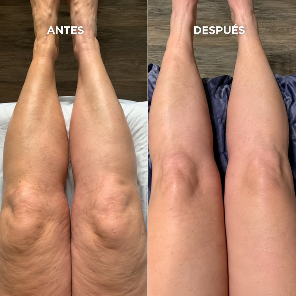 Lymphatic Drainage: Drena lo que tu cuerpo ya no necesita