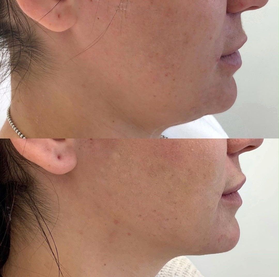 Lymphatic Drainage: Drena lo que tu cuerpo ya no necesita