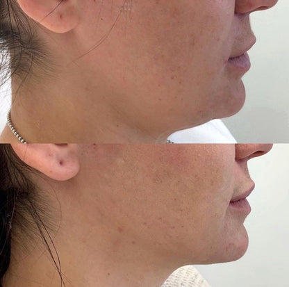 Lymphatic Drainage: Drena lo que tu cuerpo ya no necesita